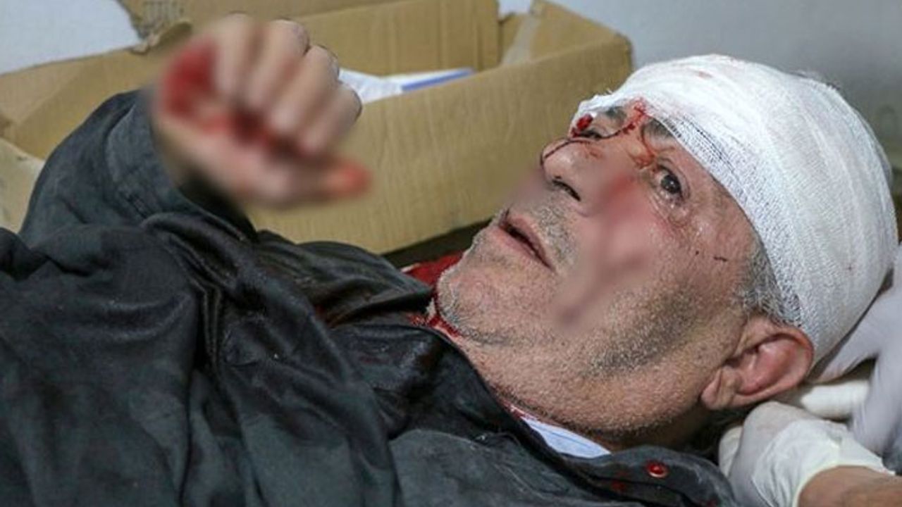 Esad rejiminden İdlib'e çifte saldırı: 7 sivil hayatını kaybetti