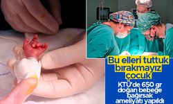 KTÜ'de 650 gr doğan bebeğe, bağırsak ameliyatı yapıldı