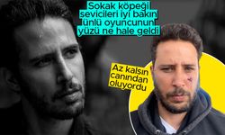 Ünlü oyuncu Tuan Tunalı'ya köpek saldırdı