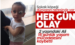 Köpeklerin saldırısına uğrayan minik Asaf hayatını kaybetti